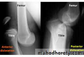 Lower limb