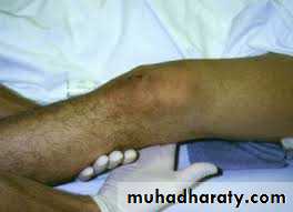 Lower limb