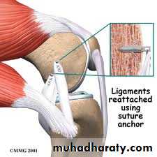 Lower limb