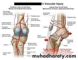 Lower limb
