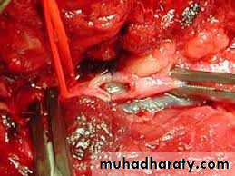 Lower limb