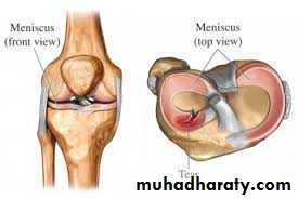 Lower limb