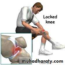 Lower limb