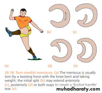 Lower limb