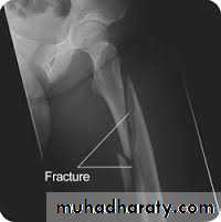 Lower limb