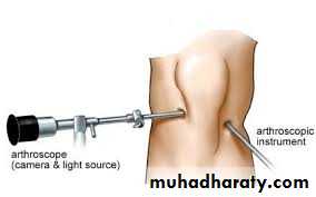 Lower limb