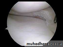 Lower limb