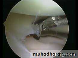 Lower limb