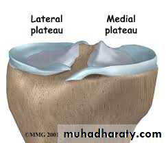 Lower limb