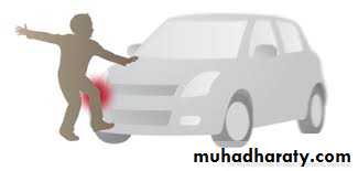 Lower limb