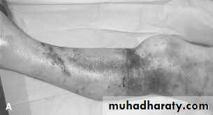 Lower limb