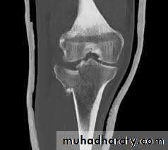 Lower limb