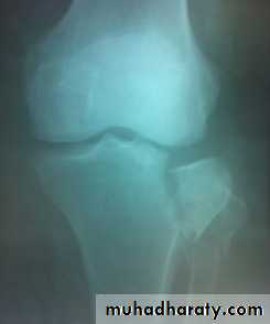 Lower limb