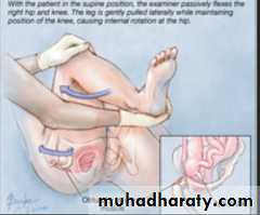 appendix