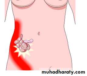 appendix