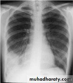 appendix