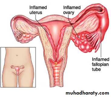 appendix