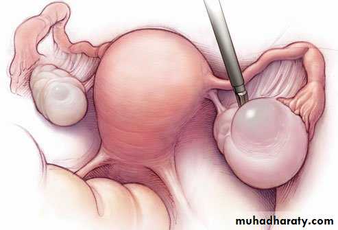 appendix