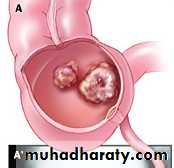 appendix