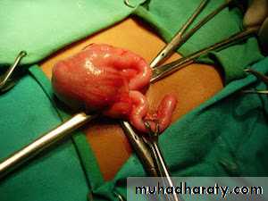 appendix