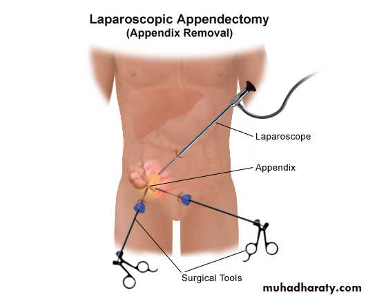 appendix