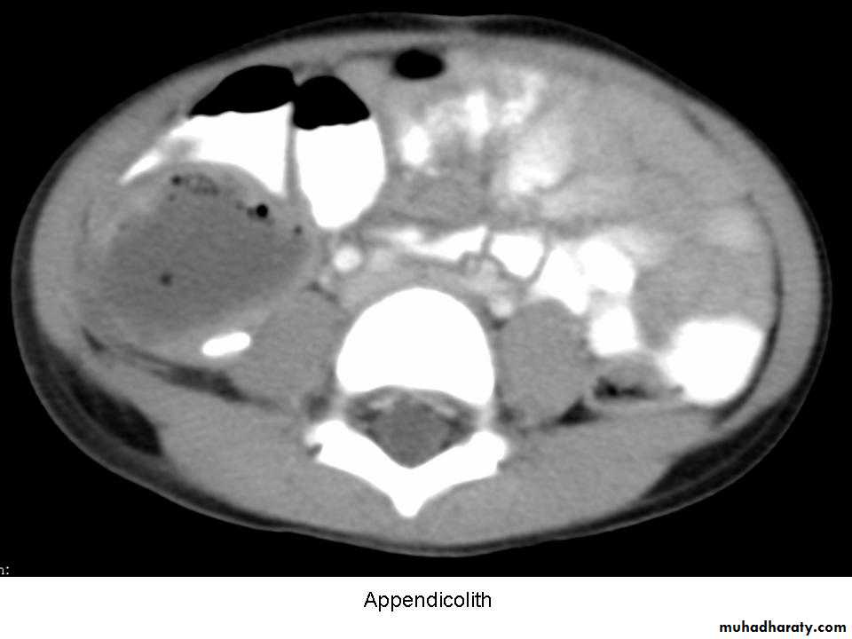 appendix