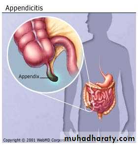 appendix