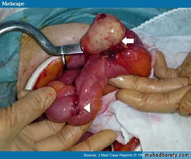 appendix