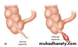 appendix