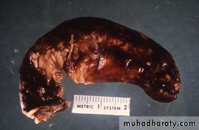appendix