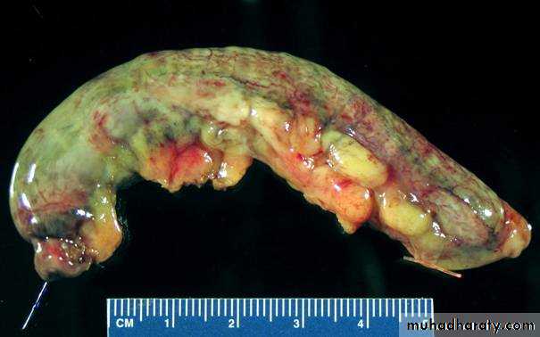appendix