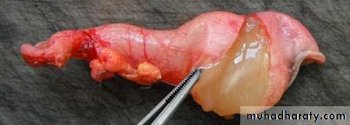 appendix