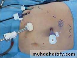 Adrenal gland