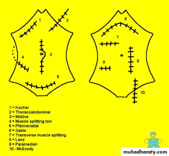 burst abdomen