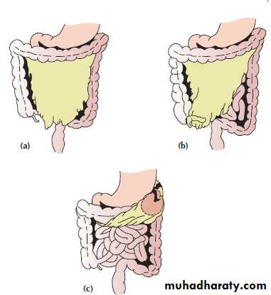 Peritonium