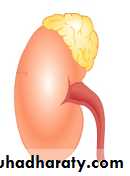Adrenal gland