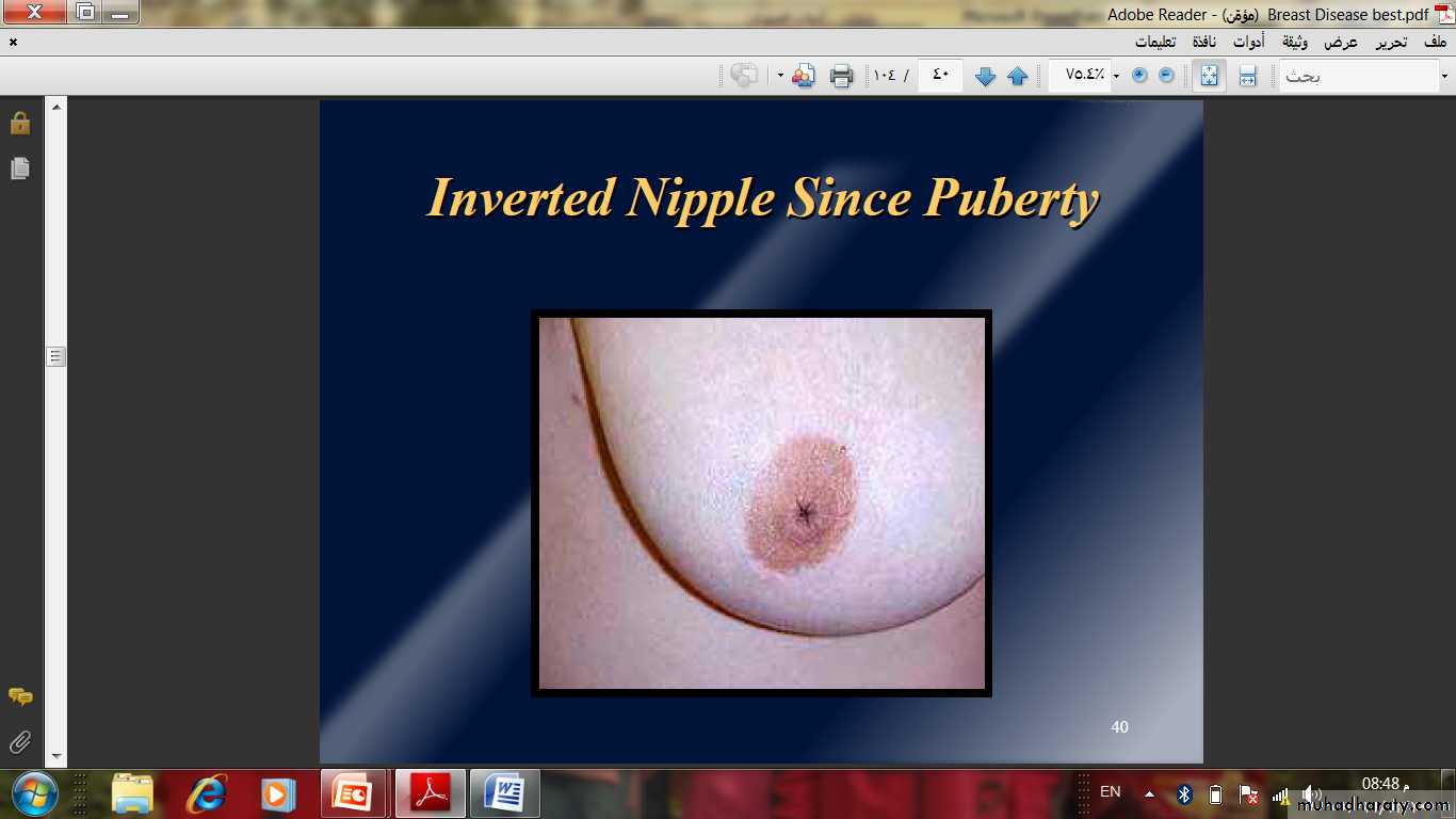 Breast