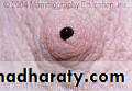Breast