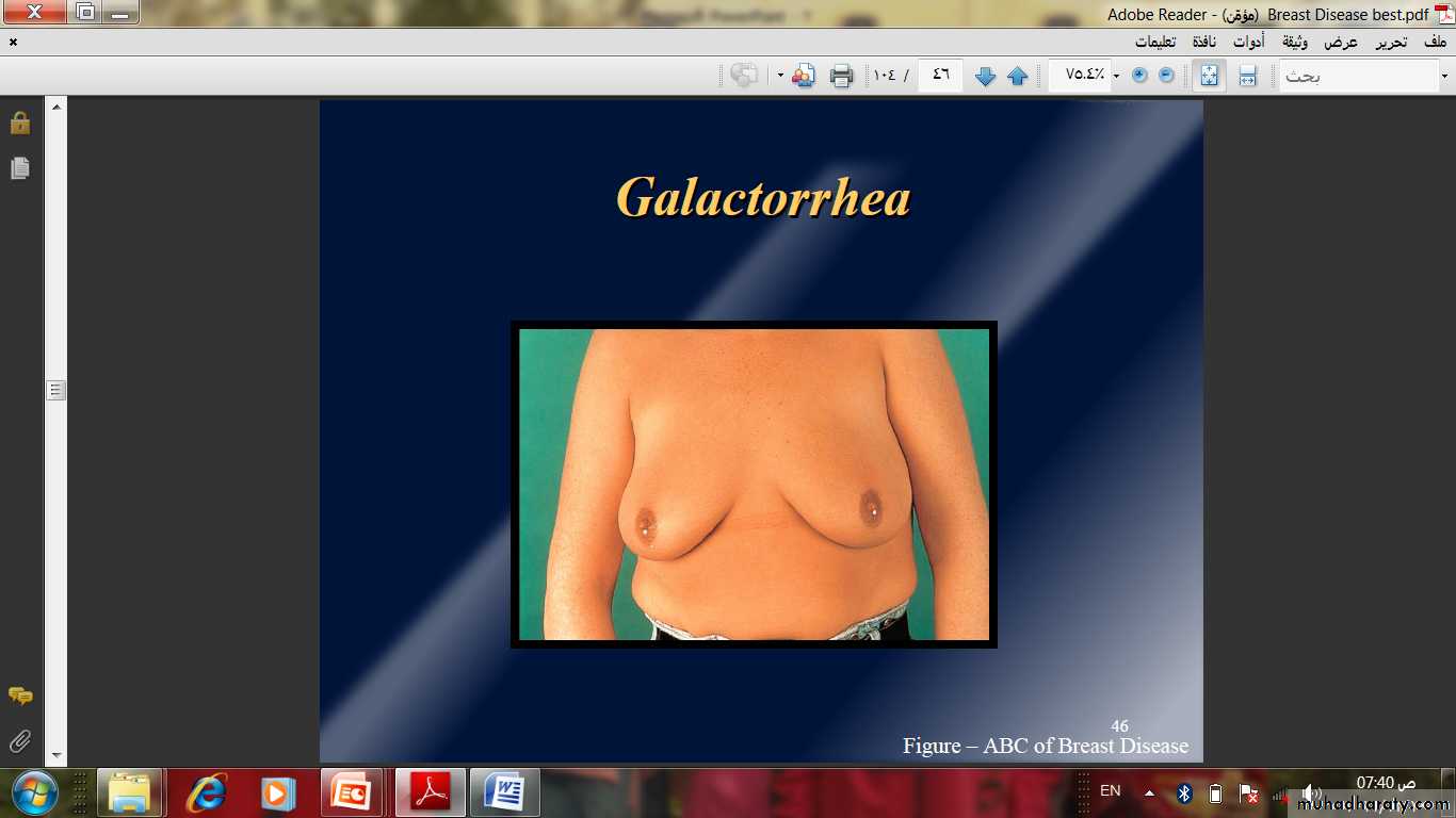 Breast