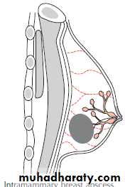 Breast