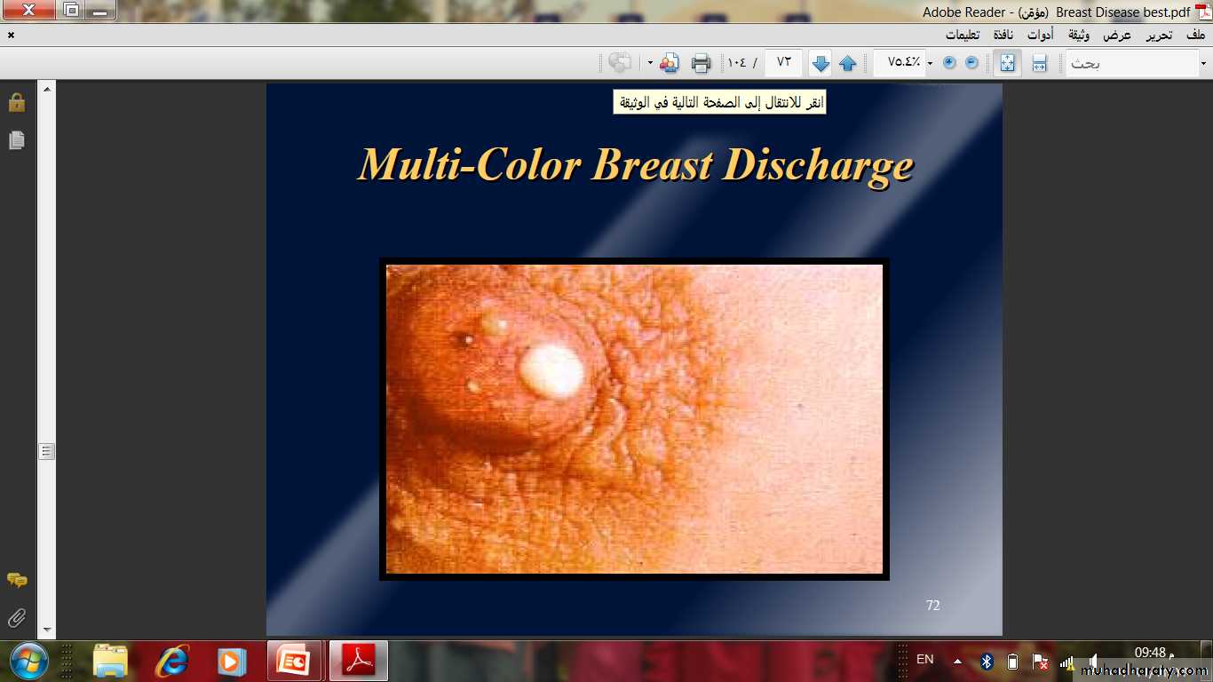 Breast