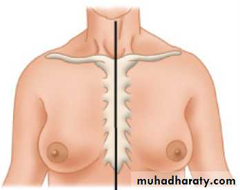 Breast