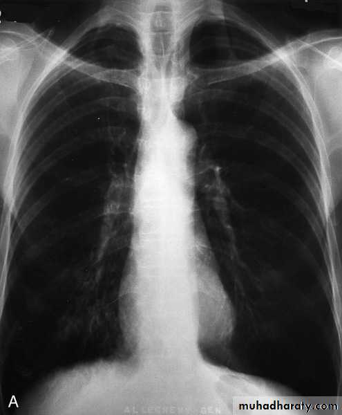 Respiratory