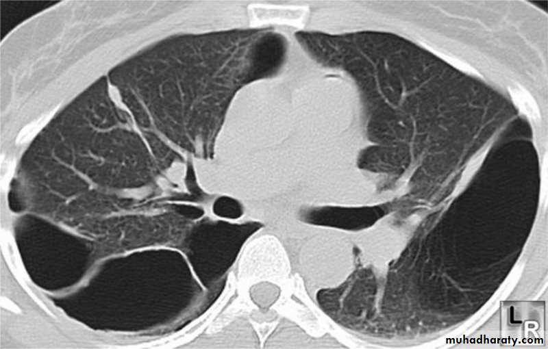 Respiratory