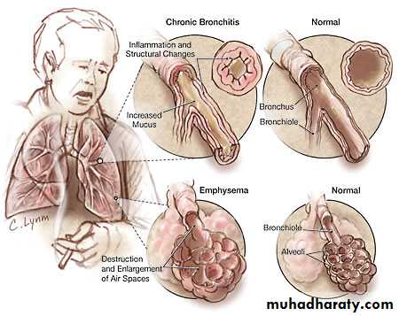Respiratory