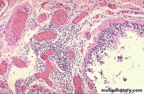 Respiratory