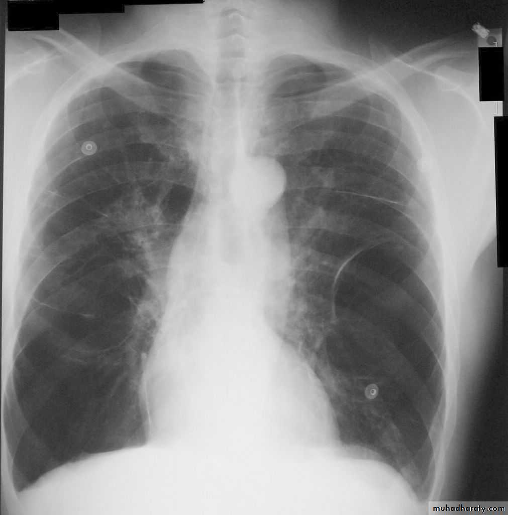 Respiratory