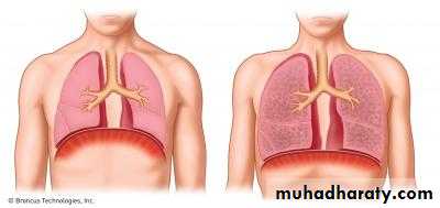 Respiratory