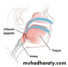 Respiratory