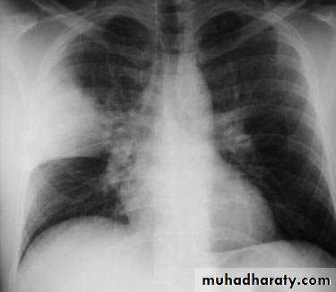 Respiratory